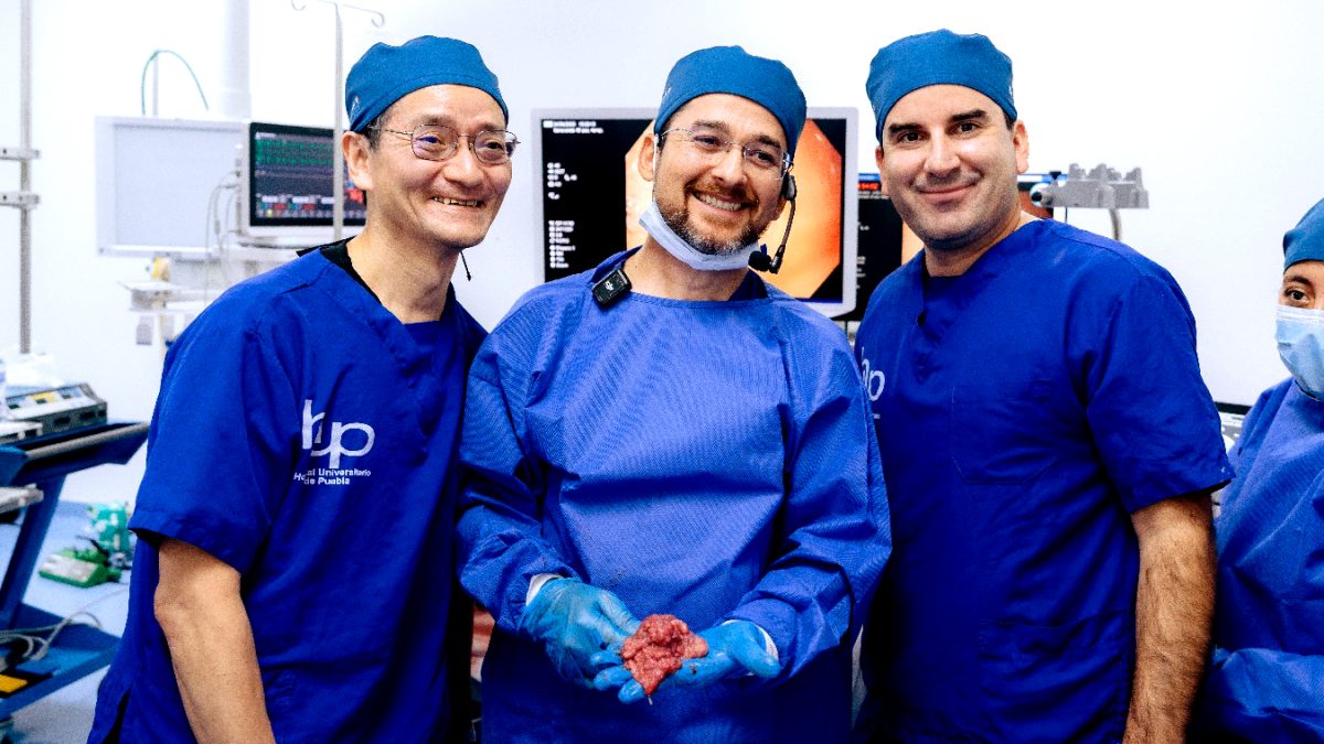 Destaca la Unidad de Endoscopía Terapéutica del Hospital Universitario de Puebla